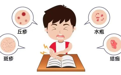 无净水无隔离！加沙水痘疫情蔓延，无数儿童在帐篷里煎熬